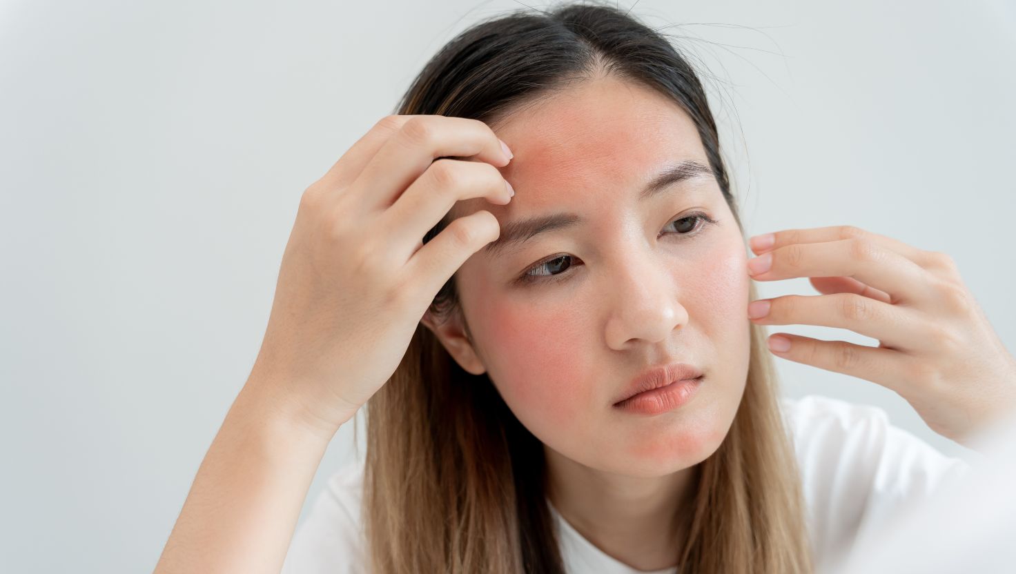 The Perfect Remedy for Rosacea: Niacinamide Serum