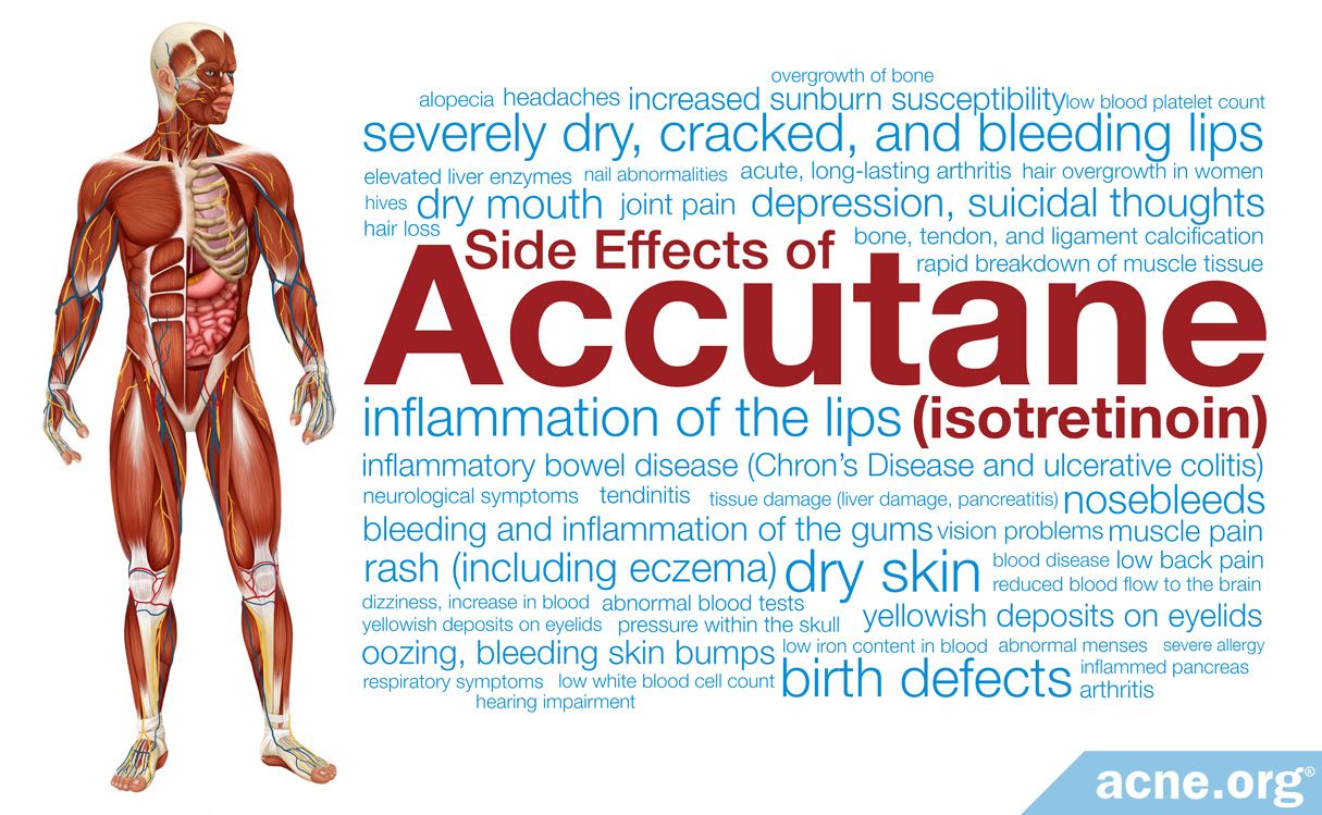 The Hidden Dangers of Accutane: