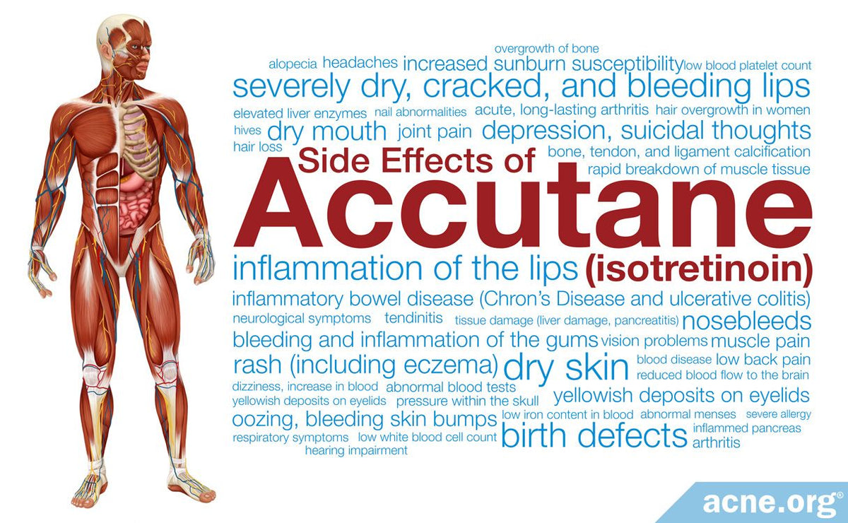 The Hidden Dangers of Accutane: