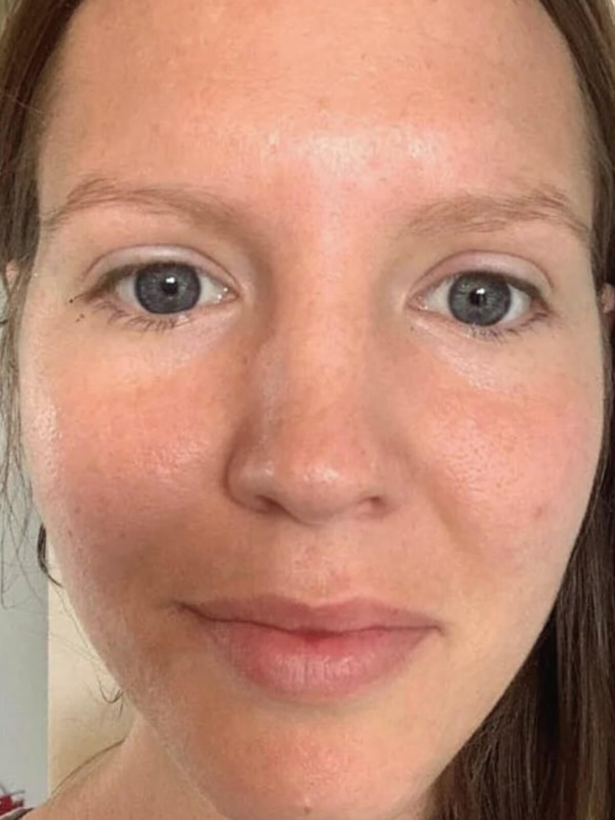 After 30 days using OM Botanical Bakuchiol Serum — smoother skin and softened fine lines